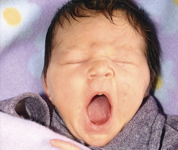Maux de ventre,  bébé chevelu?