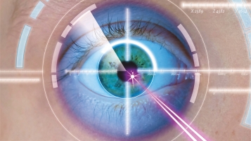 Des yeux neufs d’un coup de laser magique
