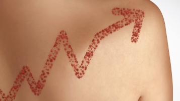 La meilleure prévention reste la vaccination