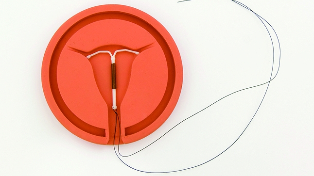 Cervical Cancer Risk