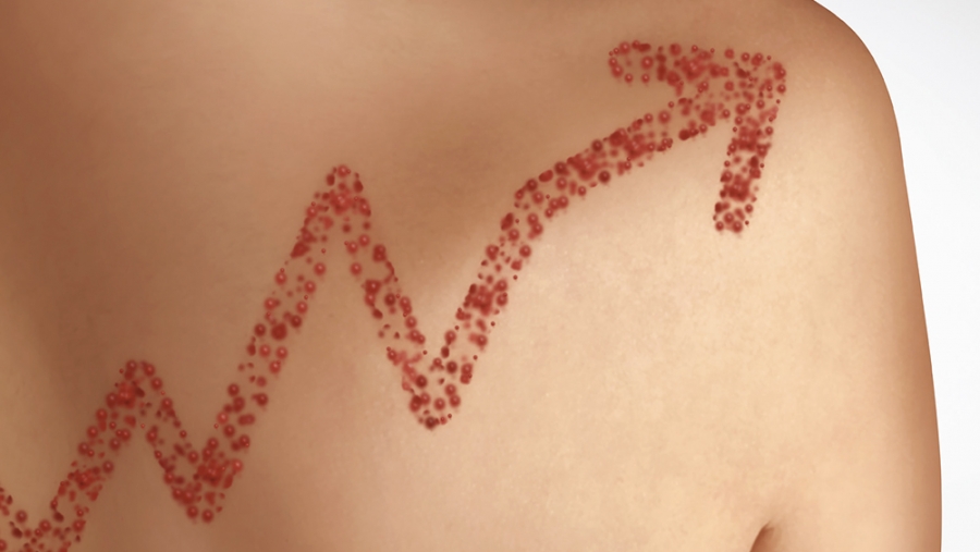La meilleure prévention reste la vaccination